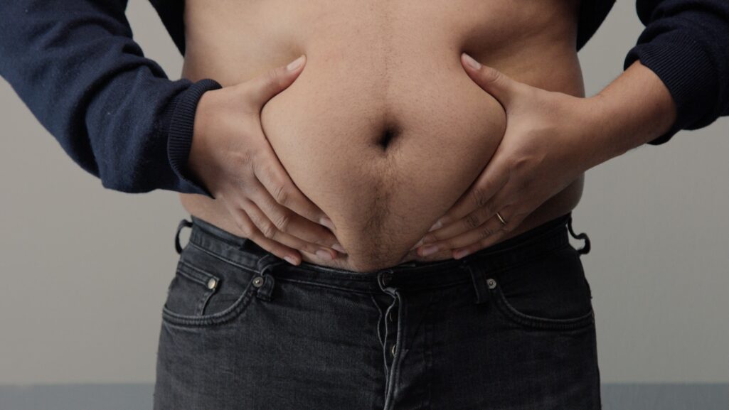 What causes tummy fat?